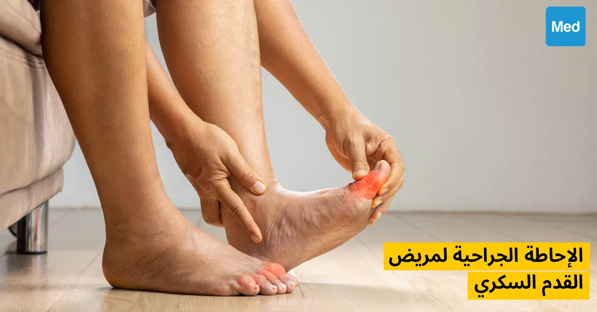 الإحاطة الجراحية لمريض القدم السكري